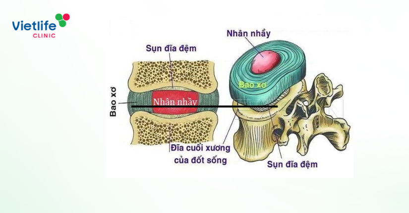 Cấu trúc đĩa đệm