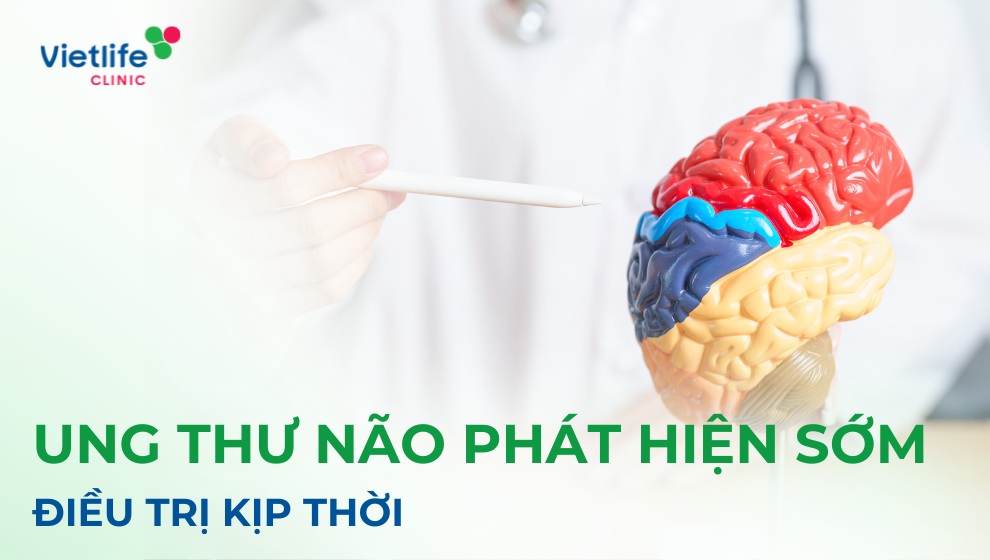 Ung thư não 